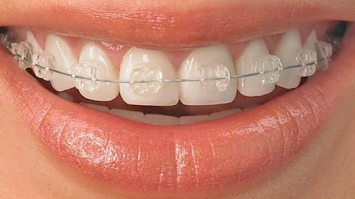 Agrawal Dental Clinic Implant and Laser Center - Agrawal Dental Clinic Implant and Laser Center