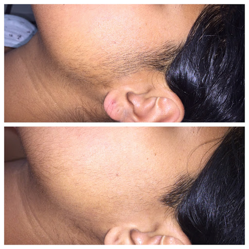 Find best chest tattoo ideas for your next unique tattoo in Raleigh at ExcelLase