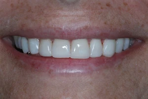Lakewood Dental Associates image