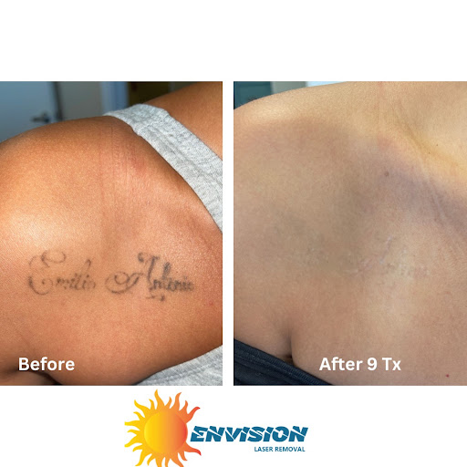 Explore tattoo ideas military, creative tattoo ideas in Port Charlotte, available at Envision Laser Removal