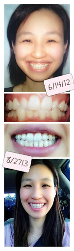 The Perfect Smile image