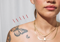 Tara Tonini L.Ac. - Photo 6 - Car repair in Brooklyn, NY, Staten Island