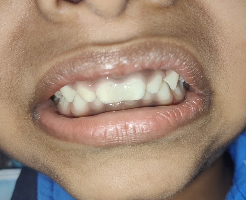 Rajaprabhu العناية بالأسنان - Rajaprabhu Dental Care