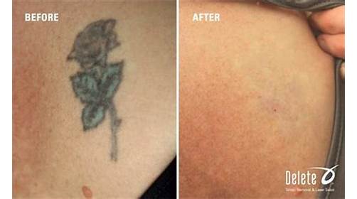 Explore folklore tattoo ideas, creative tattoo ideas in Phoenix, available at Removery Tattoo Removal & Fading