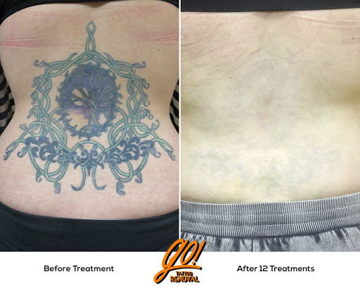 Explore medical doctor tattoo ideas, creative tattoo ideas in Allentown, available at Removery Tattoo Removal & Fading