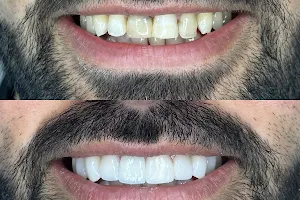 Consultorio odontológico Johan Mendoza image