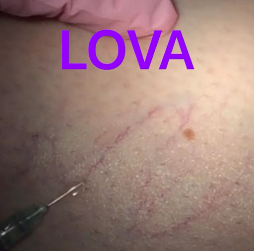 Explore full head tattoo ideas, creative tattoo ideas in Lake Oswego, available at Lake Oswego Vein and Aesthetic LOVA