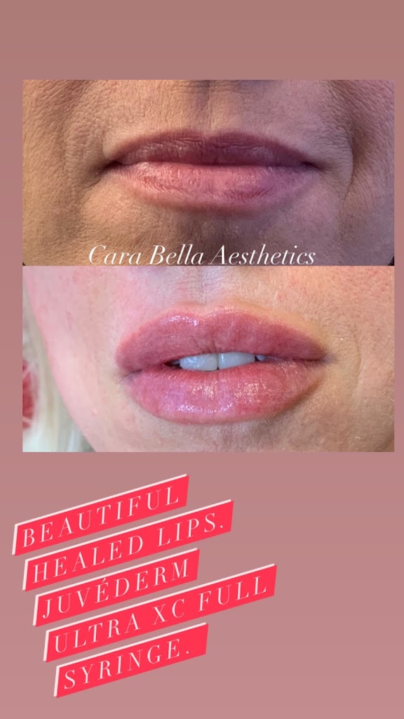 Cara Bella Aesthetics 80260