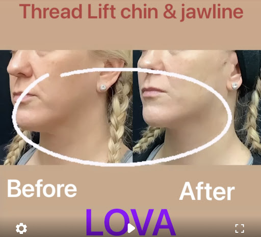 Explore simple medium tattoo ideas, creative tattoo ideas in Lake Oswego, available at Lake Oswego Vein and Aesthetic LOVA