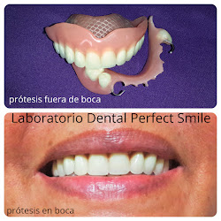 LABORATORIO DENTAL PERFECT SMILE PRÓTESIS DENTALES Y MÁS