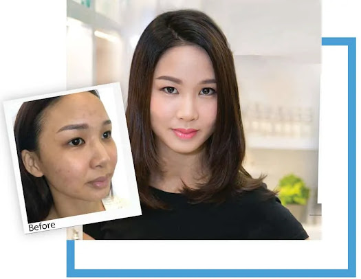 Skin Renew [Damansara Utama] - Skin Renew [Damansara Utama]