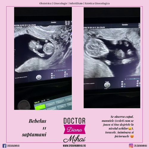 Doctor Diana Mihai - Medic Obstetrica Ginecologie Infertilitate Bucuresti - Doctor