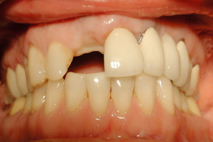 Smile Dental Implant Center - Dentists White Rock image