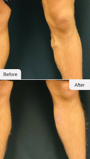 Explore tattoo ideas for sons names, creative tattoo ideas in Lake Oswego, available at Lake Oswego Vein and Aesthetic LOVA