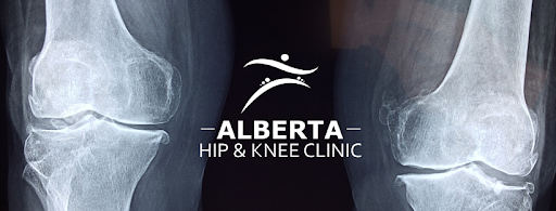 Alberta Hip and Knee Clinic