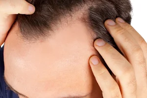 Restora Skin, Laser, Hair Clinic in Rajahmundry - Hair Transplant in Rajahmundry image