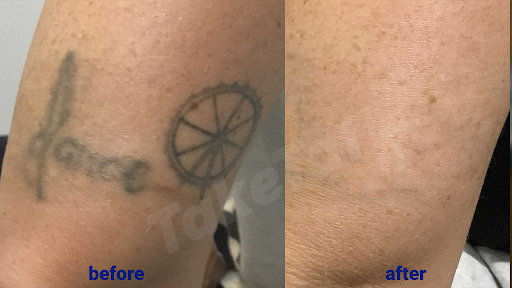 Explore meaningful nature tattoo ideas, creative tattoo ideas in Sheffield Lake, available at TakeTatt Tattoo Removal