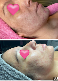 The Facial Bar - Photo 5 - Car repair in Rio Rancho, NM, Rio Rancho