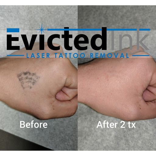 Explore phoebe bridgers tattoo ideas, creative tattoo ideas in Wichita, available at Evicted Ink Laser Tattoo Removal