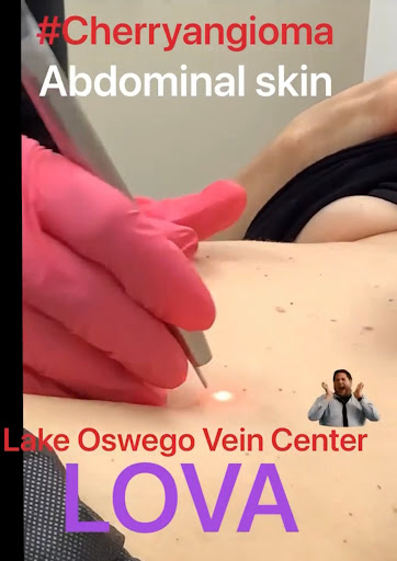 Explore tattoo ideas for free spirit, creative tattoo ideas in Lake Oswego, available at Lake Oswego Vein and Aesthetic LOVA