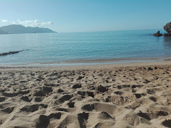 Foto de Praia de Glyfada área parcialmente resortada