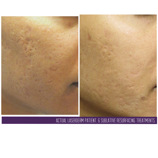 Explore year 2000 tattoo ideas, creative tattoo ideas in Baton Rouge, available at Louisiana Laserderm