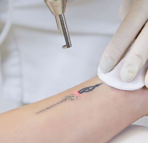 Explore mens full sleeve tattoo ideas, creative tattoo ideas in Chapin, available at Palmetto Cosmetic Surgery and Aesthetics