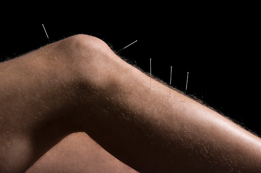 Acupuncture and Chinese medicine by Alex Humphries