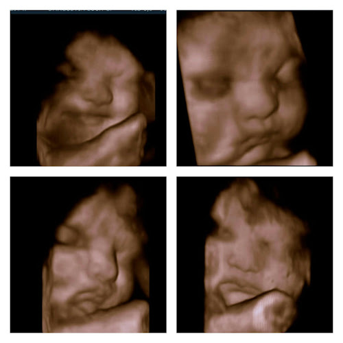 Comentarii opinii despre Unimagen Loor