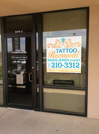 Tattoo Removal Midland