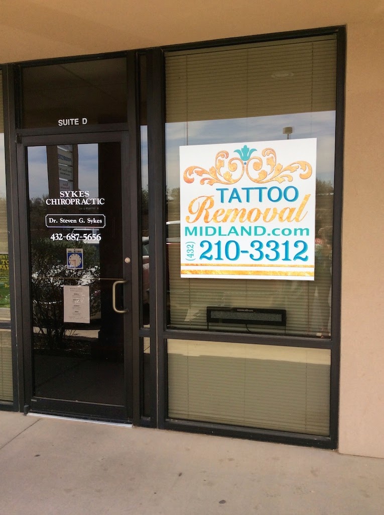 Tattoo Removal Midland 79705