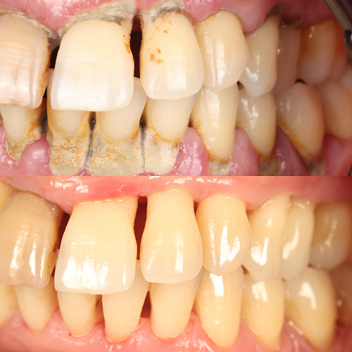 Dr.Ortho Clinic - Ομάδα Εξειδικευμένων Οδοντιάτρων - Τσοπάκης Νίκος, Ευσταθίου Αντωνία & Συνεργάτες - Εμφυτευματολογία - Ηράκλειο