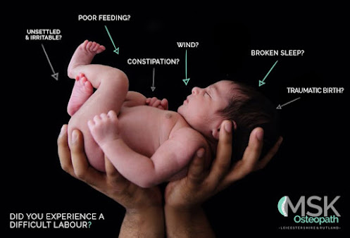 MSK Osteopath - Leicester - MSK Osteopath - Leicester