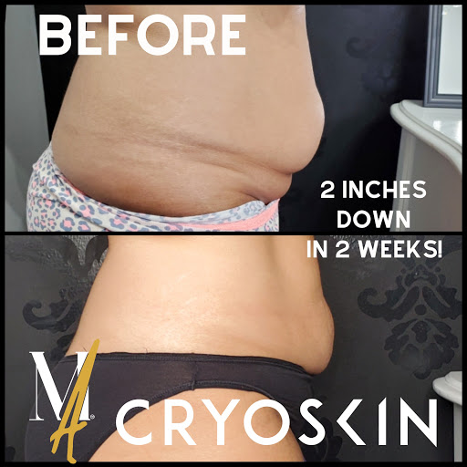 Explore breast cancer tattoo ideas, creative tattoo ideas in Oak Park, available at Microblading Oak Park by Moxie Allure