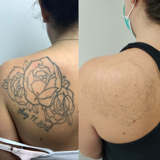 Explore grandmother tattoo ideas, creative tattoo ideas in Easton, available at Precision Laser LLC