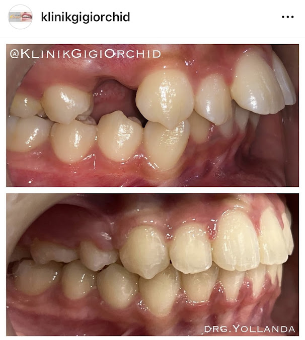 Klinik Gigi Orchid - Klinik Gigi Orchid