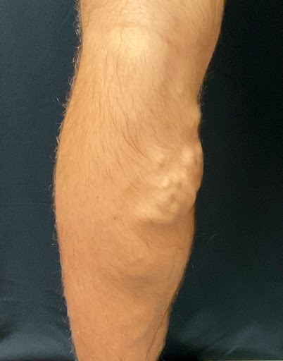 Explore mens sleeve tattoo filler ideas, creative tattoo ideas in Lake Oswego, available at Lake Oswego Vein and Aesthetic LOVA