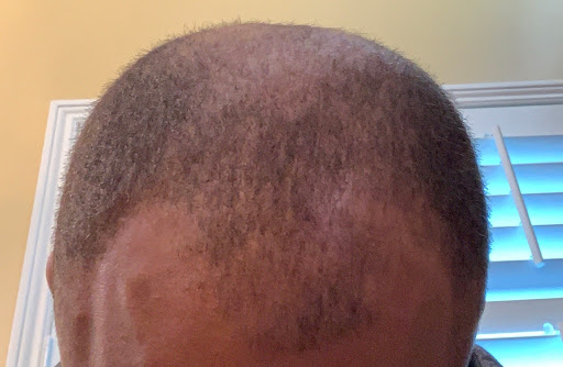 Medical Hair Transplant & Aesthetics image