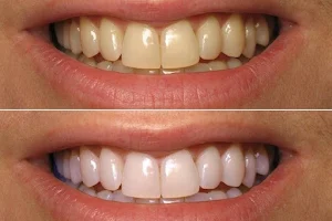 عيادة دنتال هوم لطب وزراعة الأسنان dental home clinic image