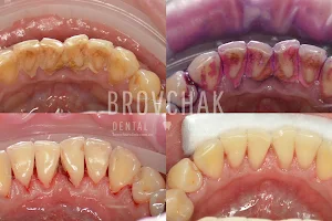Стоматология на Голосеевской Brovchak Dental. Лечение зубов под микроскопом Киев. image