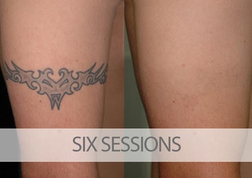 Find tattoo ideas for men 2024 for your next unique tattoo in Palm Harbor at EradiTatt Tattoo Removal of Palm HarborClearwater