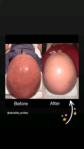 Laser Hair Removal Service «Pure Vanity Spa», reviews and photos, 20511 N Hayden Rd, Scottsdale, AZ 85255, USA