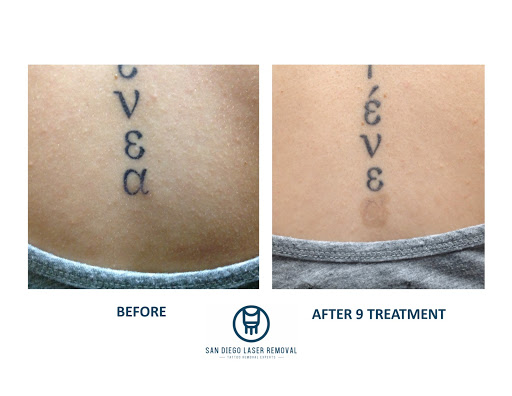 Explore tattoo ideas inner bicep, creative tattoo ideas in San Diego, available at Removery Tattoo Removal & Fading