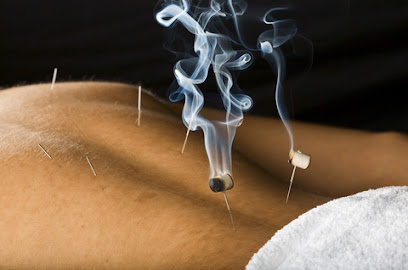 Stillpoint Acupuncture