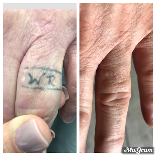 Explore birth date tattoo ideas for guys, creative tattoo ideas in Longview, available at Vanish Laser Aesthetics