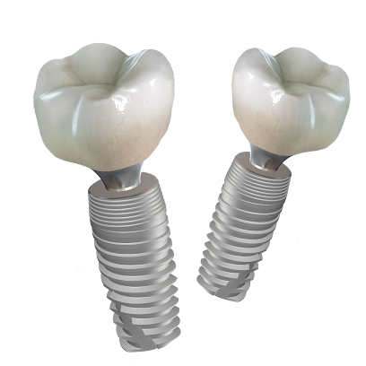 TISS植牙 植體系統 植牙矯正系統 補骨系統 牙材商 人工牙根 台灣高雄