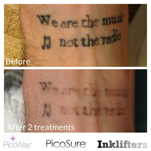 Explore walking dead tattoo ideas, creative tattoo ideas in Pleasant Grove, available at Inklifters Tattoo Removal