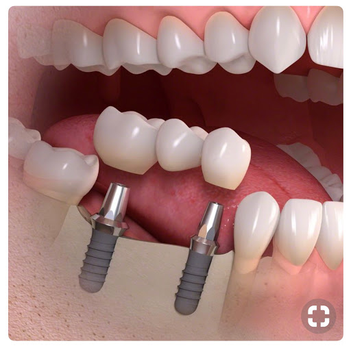 Esthetix Dentist, NYCs Dental Implant & Cosmetic Specialist image 5