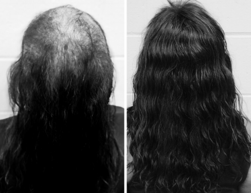 Mane Solutions - Non-Surgical Hair Replacement 91910