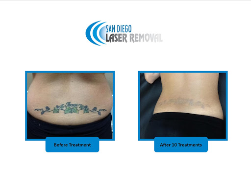 Explore half chest tattoos for men ideas, creative tattoo ideas in San Diego, available at Removery Tattoo Removal & Fading